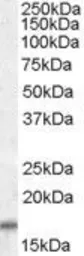 Anti-COX4I2 antibody, C-term used in Western Blot (WB). GTX47597