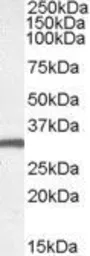 Anti-EN2 antibody, C-term used in Western Blot (WB). GTX47599