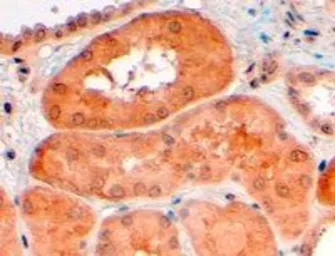 Anti-PCSK9 antibody, C-term used in IHC (Paraffin sections) (IHC-P). GTX47601