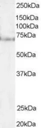 Anti-Pescadillo antibody used in Western Blot (WB). GTX47602