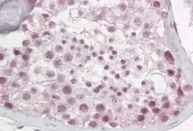 Anti-Pescadillo antibody used in IHC (Paraffin sections) (IHC-P). GTX47602
