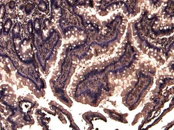 Anti-TRIM5 antibody, N-term used in IHC (Paraffin sections) (IHC-P). GTX47603