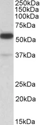 Anti-TRIM5 antibody, N-term used in Western Blot (WB). GTX47603