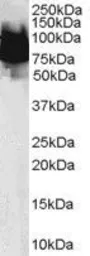 Anti-KLF4 antibody, N-term used in Western Blot (WB). GTX47604