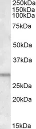 Anti-ATF5 antibody, C-term used in Western Blot (WB). GTX47605