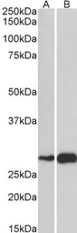 Anti-ATF5 antibody, C-term used in Western Blot (WB). GTX47605