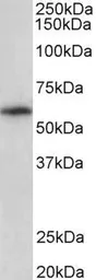 Anti-TXK antibody, C-term used in Western Blot (WB). GTX47607