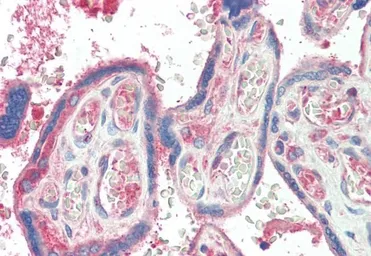 Anti-TXK antibody, C-term used in IHC (Paraffin sections) (IHC-P). GTX47607