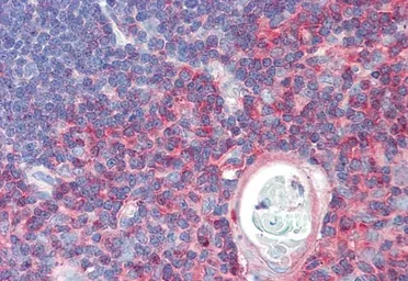 Anti-TXK antibody, C-term used in IHC (Paraffin sections) (IHC-P). GTX47607