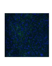 Anti-HTR3E antibody, Internal used in Immunocytochemistry/ Immunofluorescence (ICC/IF). GTX47615
