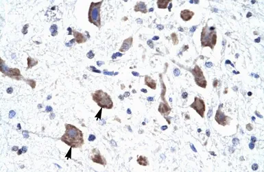 Anti-CLCN3 antibody, C-term used in IHC (Paraffin sections) (IHC-P). GTX47617