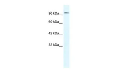 Anti-CLCN3 antibody, C-term used in Western Blot (WB). GTX47617