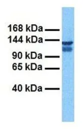 Anti-CLCN3 antibody, C-term used in Western Blot (WB). GTX47617