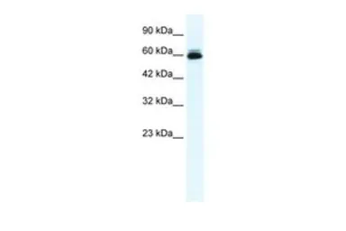 Anti-KCNH5 antibody, N-term used in Western Blot (WB). GTX47623