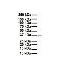 Anti-KCNAB2 antibody, C-term used in Western Blot (WB). GTX47628