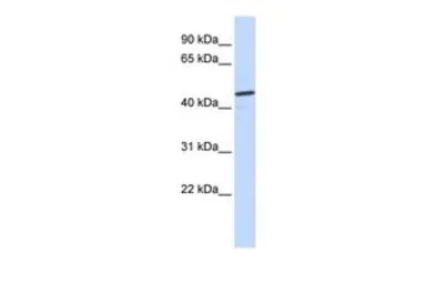 Anti-CATSPER2 antibody, N-term used in Western Blot (WB). GTX47631