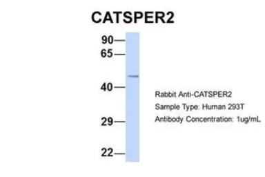 Anti-CATSPER2 antibody, N-term used in Western Blot (WB). GTX47631