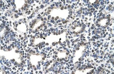 Anti-KCTD6 antibody, N-term used in IHC (Paraffin sections) (IHC-P). GTX47635