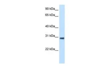 Anti-KCTD6 antibody, N-term used in Western Blot (WB). GTX47635