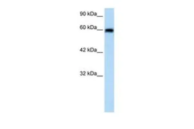 Anti-Bestrophin 4 antibody, N-term used in Western Blot (WB). GTX47636
