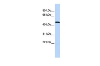 Anti-5-HT3C receptor antibody, Internal used in Western Blot (WB). GTX47641