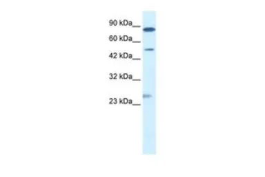 Anti-CLIC6 antibody, Internal used in Western Blot (WB). GTX47642