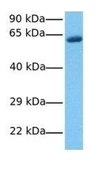 Anti-MCOLN1 antibody, N-term used in Western Blot (WB). GTX47664