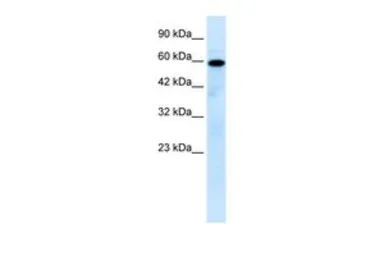 Anti-MCOLN1 antibody, N-term used in Western Blot (WB). GTX47664