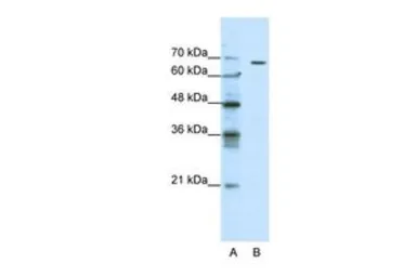 Anti-GABA A Receptor theta antibody, N-term used in Western Blot (WB). GTX47668