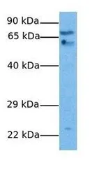 Anti-GABA A Receptor theta antibody, N-term used in Western Blot (WB). GTX47668