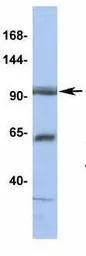 Anti-TPCN1 antibody, N-term used in Western Blot (WB). GTX47670