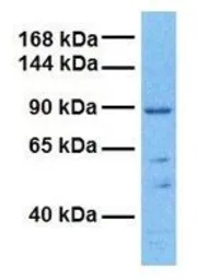 Anti-TPCN1 antibody, N-term used in Western Blot (WB). GTX47670