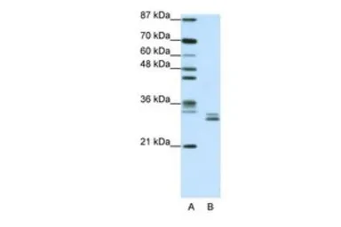 Anti-CLIC5 antibody, C-term used in Western Blot (WB). GTX47671
