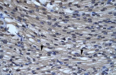 Anti-CLIC5 antibody, C-term used in IHC (Paraffin sections) (IHC-P). GTX47672