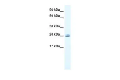 Anti-CLIC5 antibody, C-term used in Western Blot (WB). GTX47672
