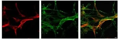 Anti-MLC1 antibody, Internal used in Immunocytochemistry/ Immunofluorescence (ICC/IF). GTX47676