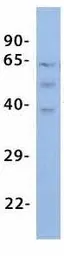 Anti-MLC1 antibody, Internal used in Western Blot (WB). GTX47676