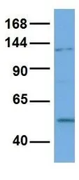 Anti-Nav1.6 antibody, Internal used in Western Blot (WB). GTX47678