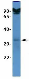 Anti-VDAC3 antibody, N-term used in Western Blot (WB). GTX47682
