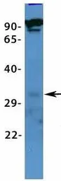 Anti-VDAC3 antibody, N-term used in Western Blot (WB). GTX47682