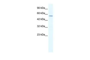 Anti-KCNA10 antibody, Internal used in Western Blot (WB). GTX47683