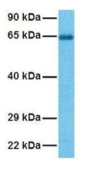 Anti-ASIC3 antibody, N-term used in Western Blot (WB). GTX47689