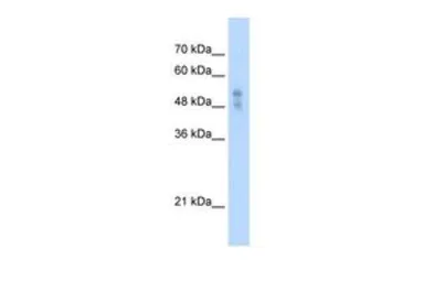 Anti-P2X1 antibody, Internal used in Western Blot (WB). GTX47691