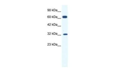 Anti-KCNN1 antibody, C-term used in Western Blot (WB). GTX47694