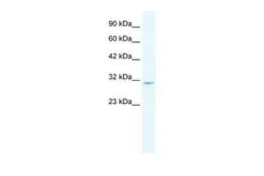 Anti-CLIC2 antibody, C-term used in Western Blot (WB). GTX47699