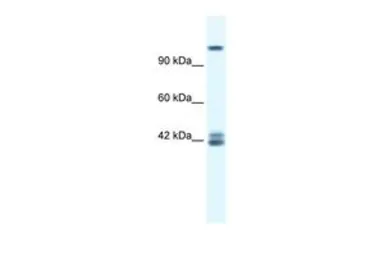 Anti-NMDAR2C antibody, N-term used in Western Blot (WB). GTX47702