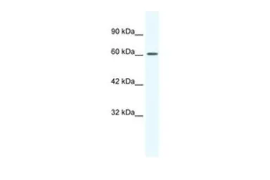 Anti-Cav beta 2 antibody, Internal used in Western Blot (WB). GTX47706
