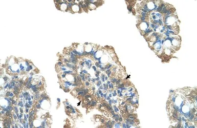 Anti-PARP6 antibody, C-term used in IHC (Paraffin sections) (IHC-P). GTX47710