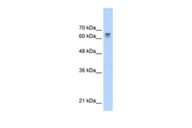 Anti-PARP6 antibody, C-term used in Western Blot (WB). GTX47710