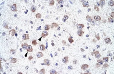 Anti-RALY antibody, N-term used in IHC (Paraffin sections) (IHC-P). GTX47714